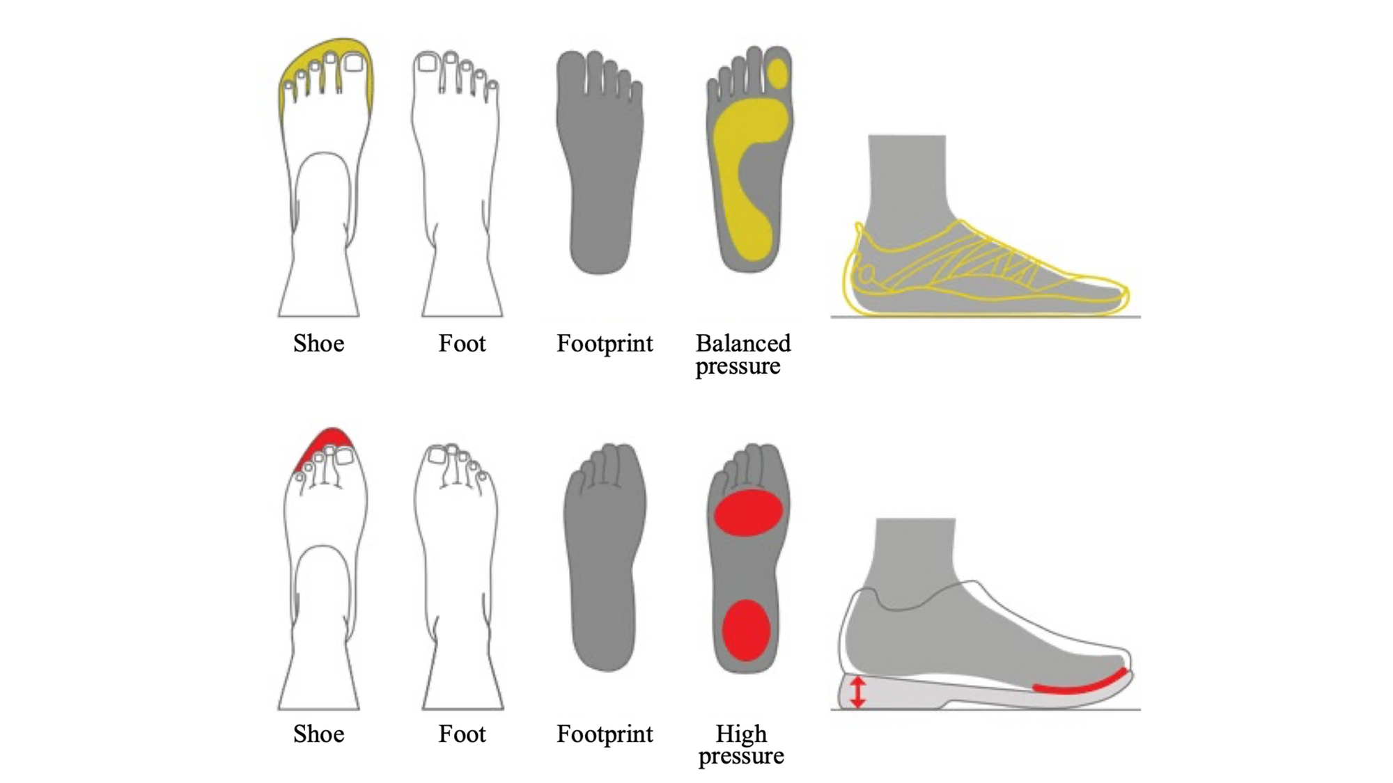 Feet and Footwear: Applying Biological Design and Mismatch